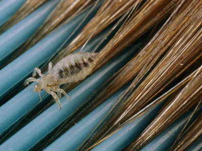 Pediculosis (Head Lice) - Stamford Skin Centre