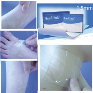 scar_clinic_clear_product_picture