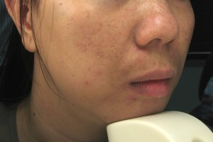 Truong, Thi Kim Khanh 20101007 Spots l