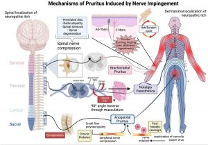 Đau và ngứa do bệnh lý thần kinh